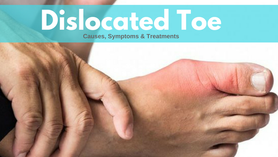 Dislocated Toe