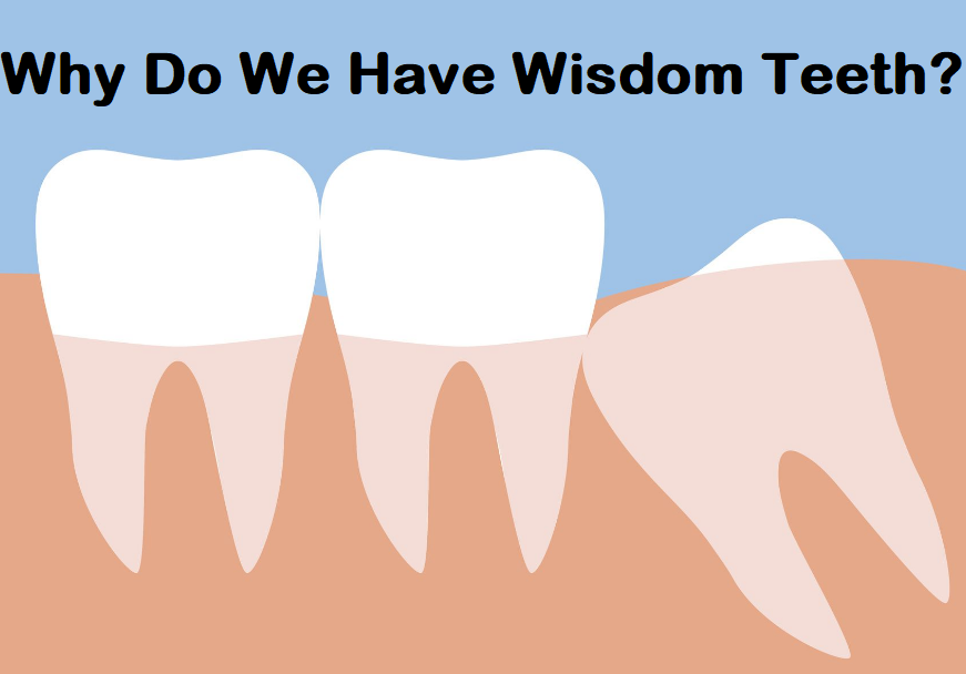 Why Do We Have Wisdom Teeth